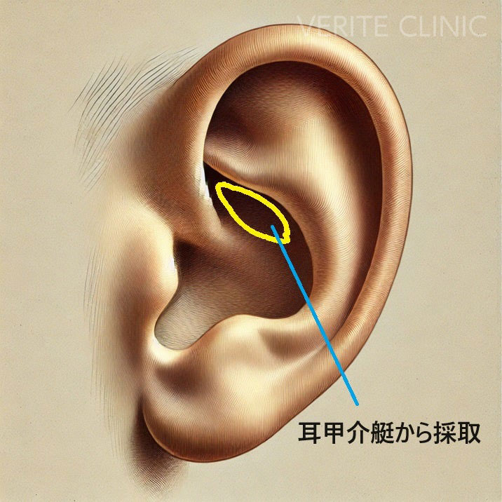 耳甲介艇