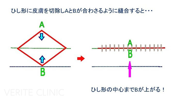口角が上がるイメージ図