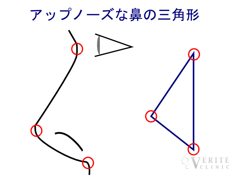 アップノーズな鼻の三角形
