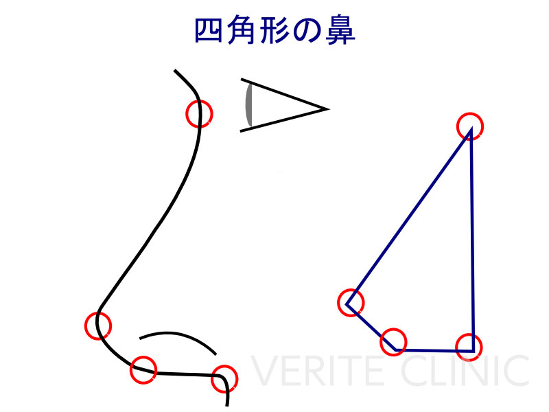 四角形の鼻
