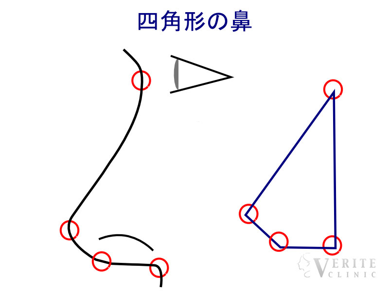 四角形の鼻